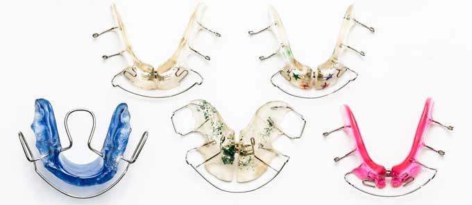 Braces or plates in bite treatment