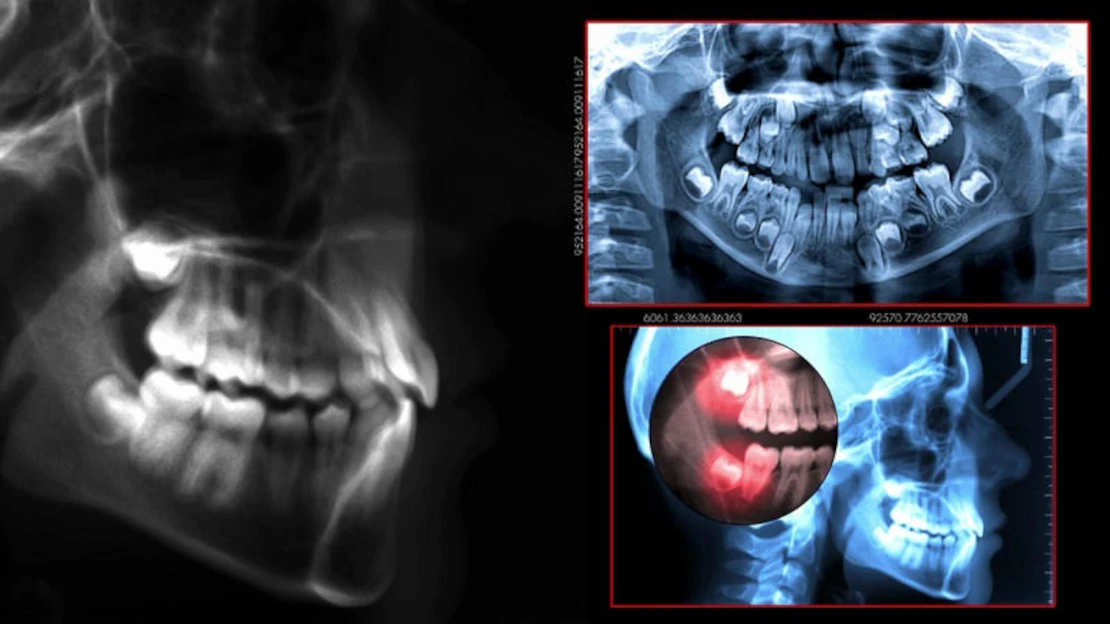 Dental treatment and implantation in Cherkassy and the region