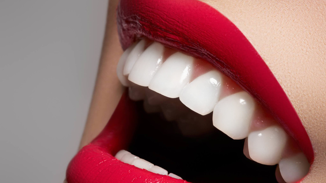 photo of a smile after oral hygiene at home