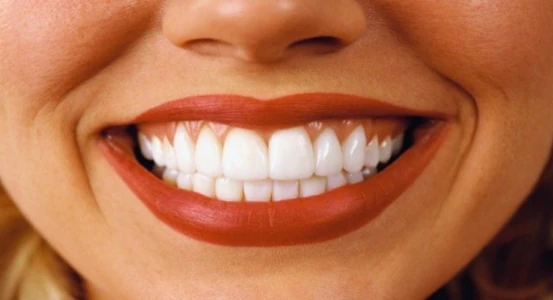 photo of a woman's smile after dental treatment