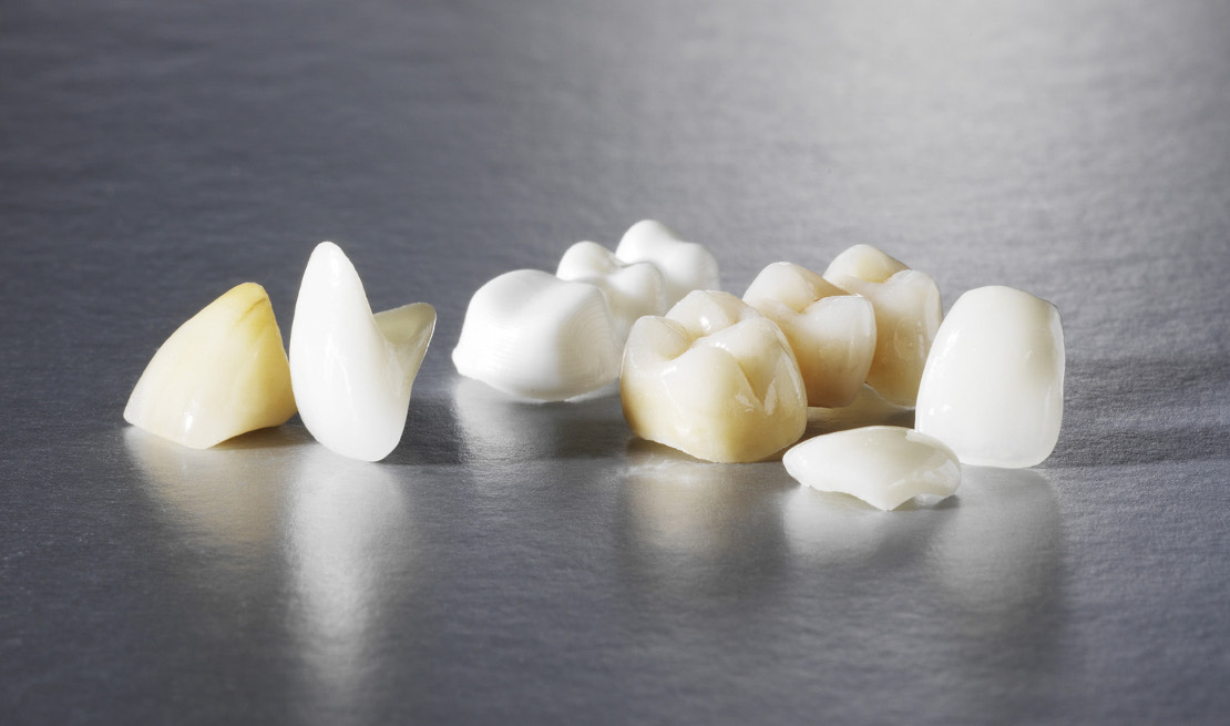 crown placement at Bagita Dental Clinic in Cherkassy