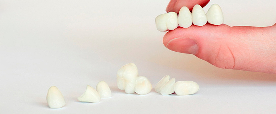 dental crowns in the dental clinic in Cherkassy Bagita