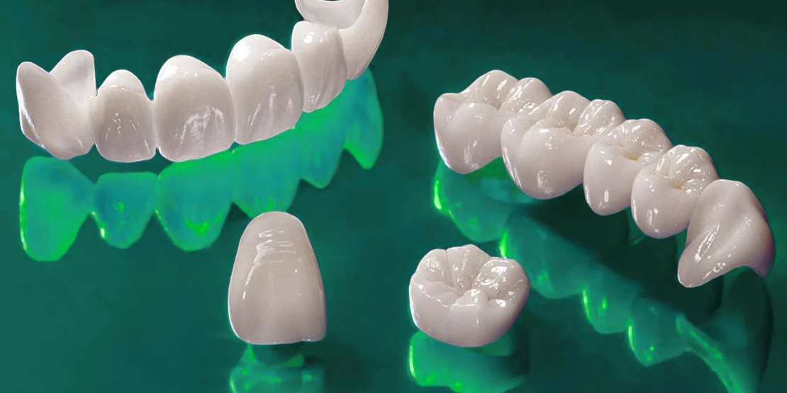 photo ceramic crowns for prosthetics in the Bagita Dental Clinic in Cherkassy