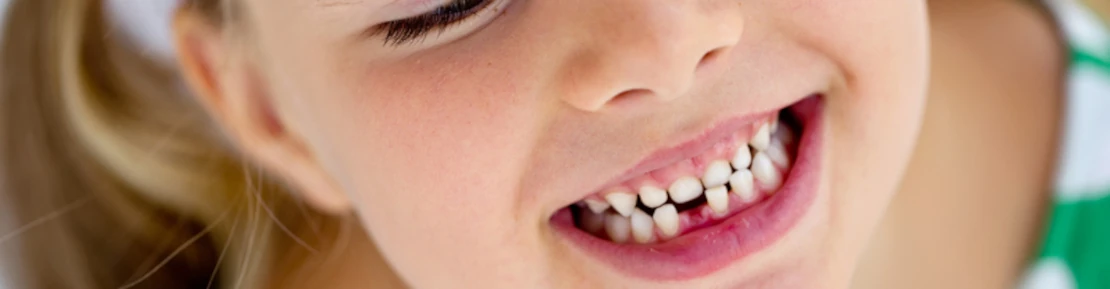 picture of a baby with baby teeth