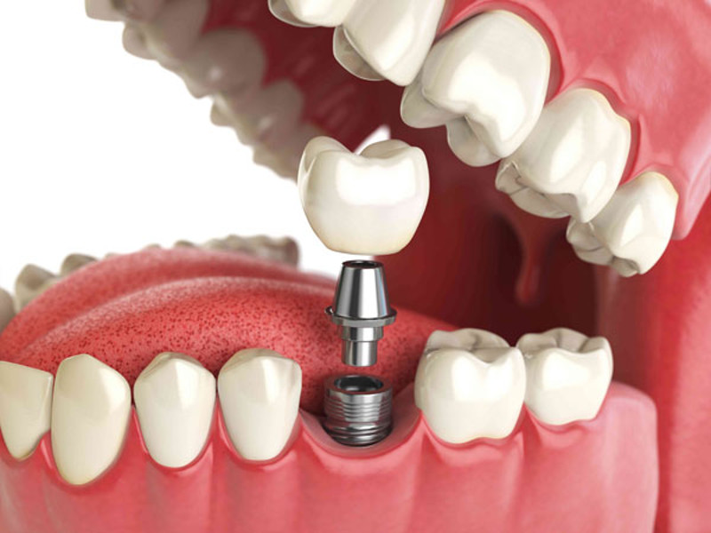 dental treatment in Cherkassy