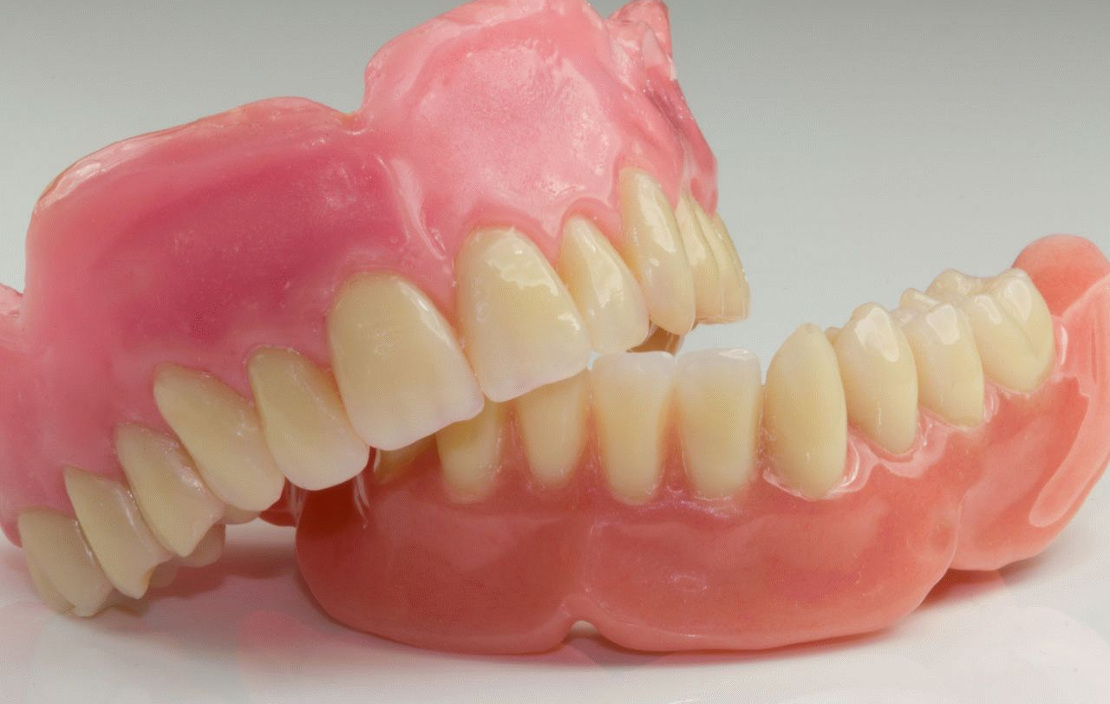 on the photo dental prostheses to be installed in the Bagita Dental Clinic in Cherkassy