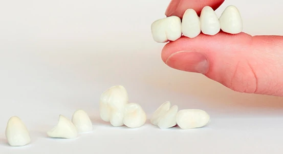 dental crowns in the dental clinic in Cherkassy Bagita