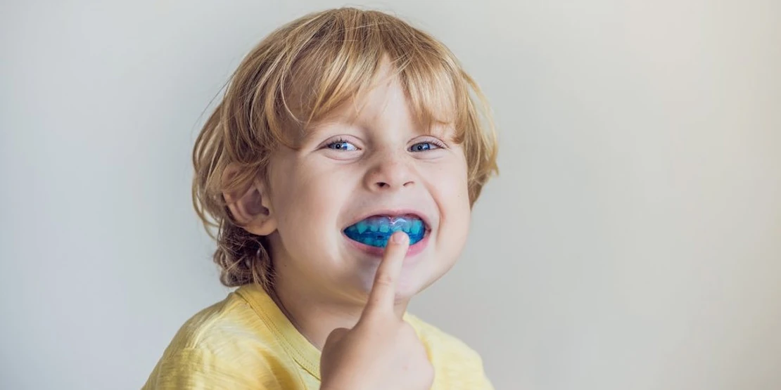 the photo shows a child with an orthodontic plate for bite correction