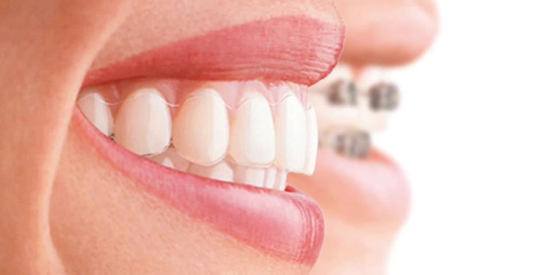 photo shows a patient's smile after having her bite corrected with braces by an orthodontist