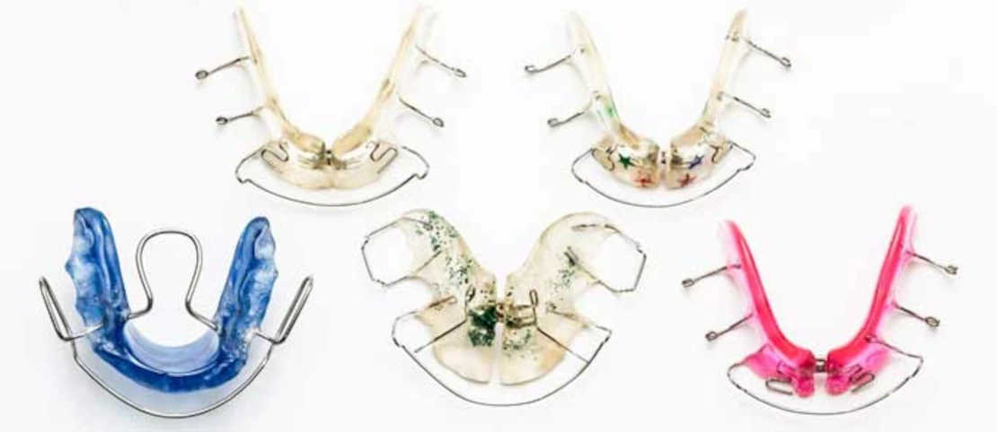 on the photo orthodontic plates for bite correction in Cherkassy orthodontist in clinic Bagita