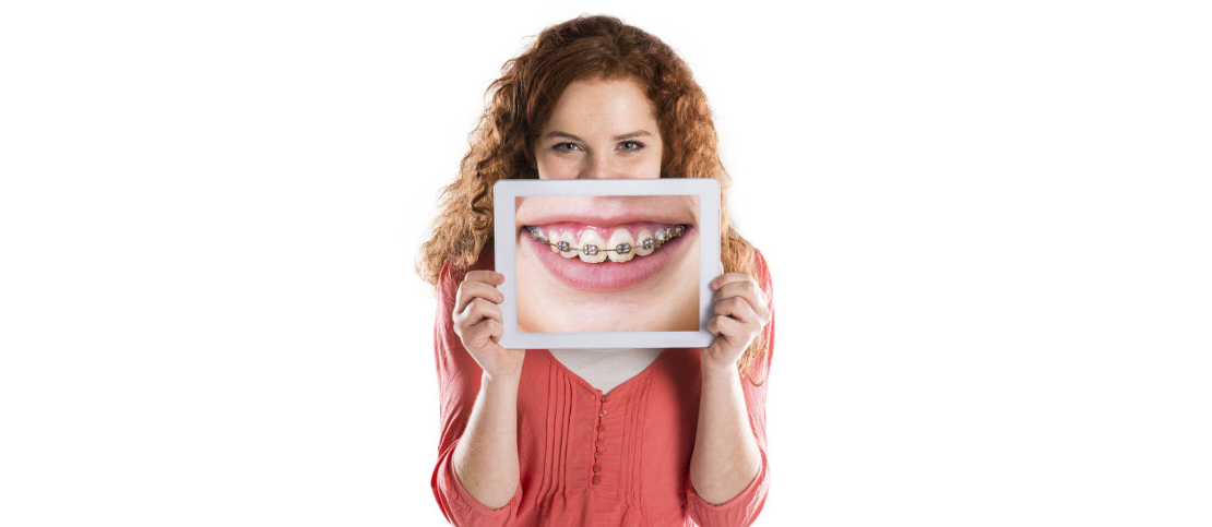 the girl with the picture of the braces on her teeth