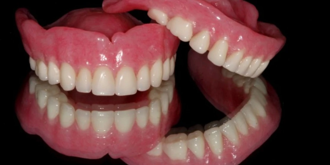 implant rejection