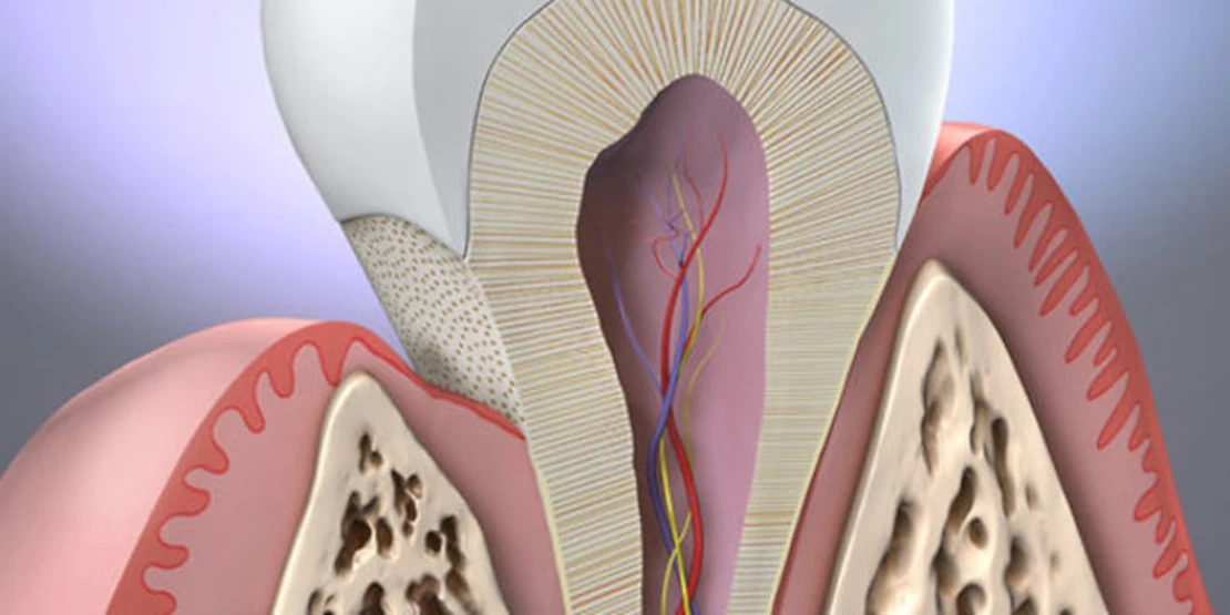 dental disease affects the heart photo