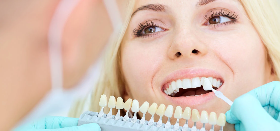 color selection for dentures at Bagita Dental Clinic