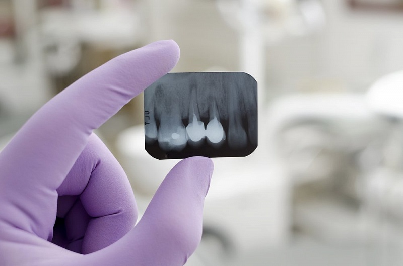 Dental X-ray in Cherkassy dentistry