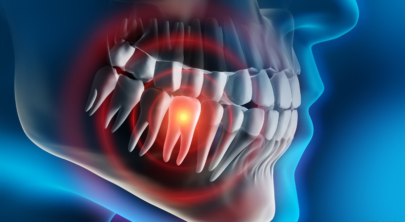dental x-ray in Cherkassy