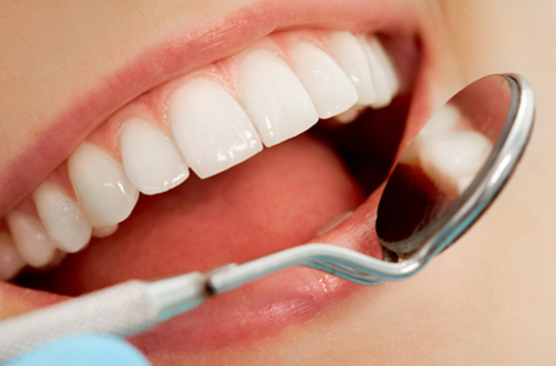 Dental treatment and checkup at Bagita Dental Clinic in Cherkassy
