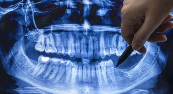 dental records