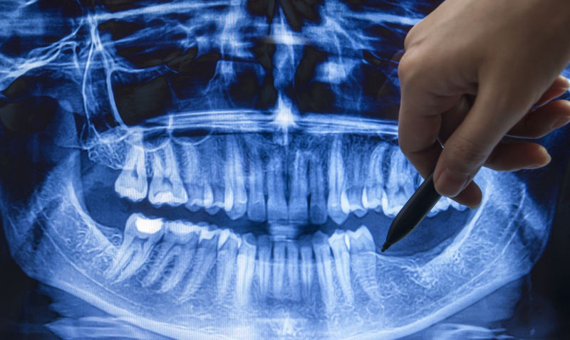 dental x-ray