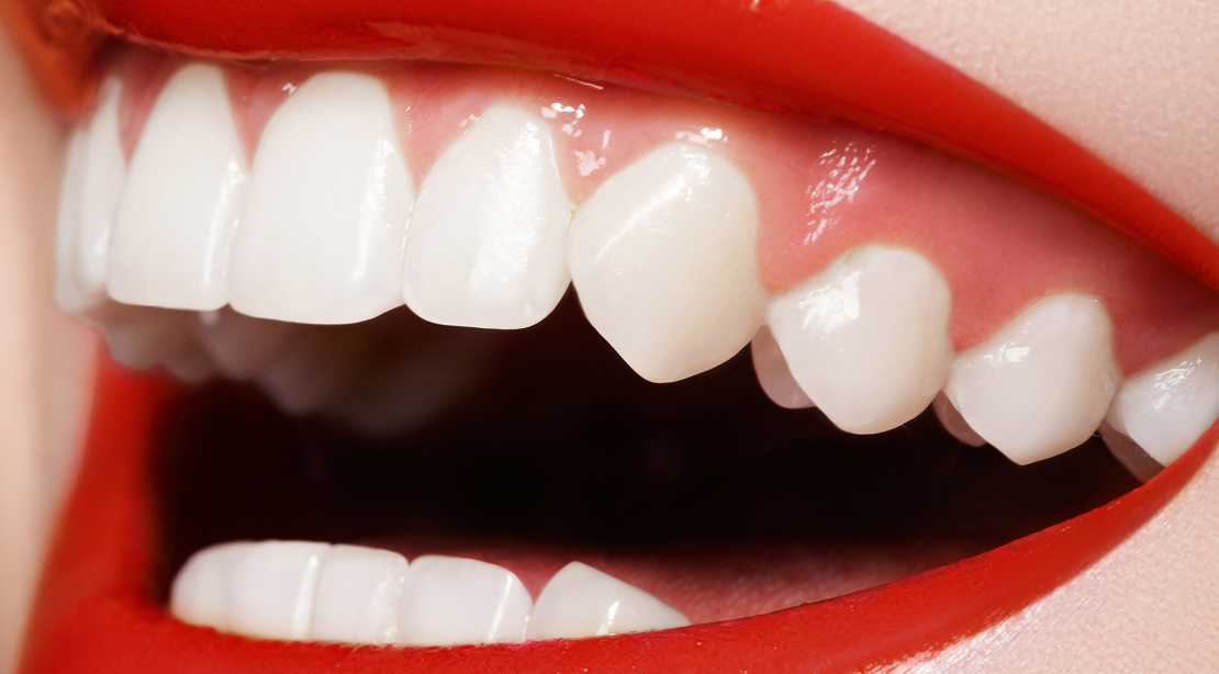 A girl's smile after dental treatment at Bagita Dental Clinic in Cherkassy