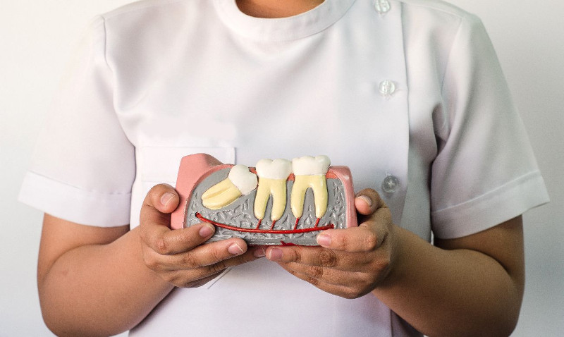 wisdom teeth questions