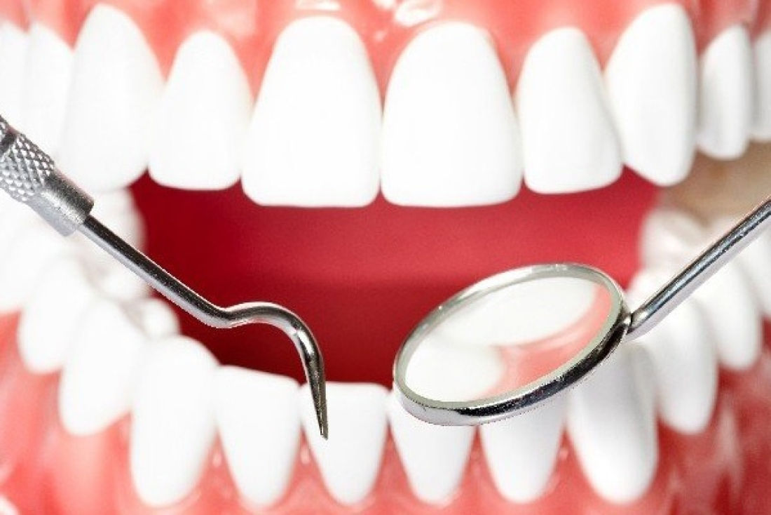 A beautiful smile with white teeth and a working dental tool